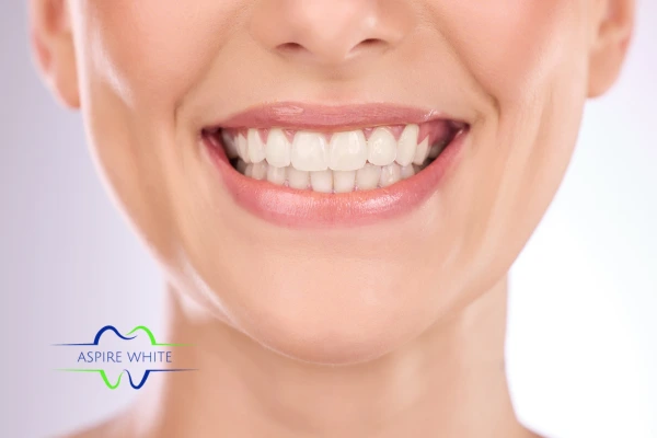 Follow your teeth whitening aftercare Dudley to prolong your whiter smile!