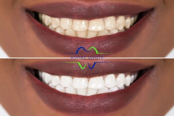 Side-by-side comparison showing before and after results of a cosmetic treatment Dudley